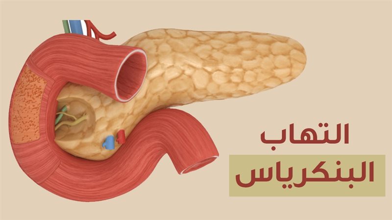 التهاب البنكرياس