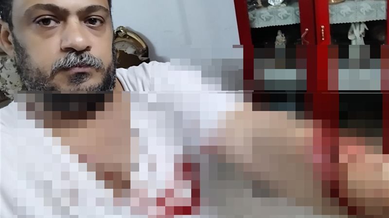 صاحب الفرن بعد الاعتداء