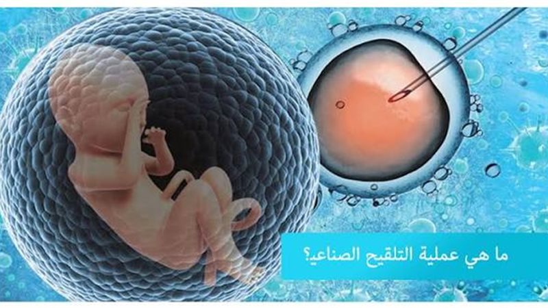 التلقيح الصناعي،