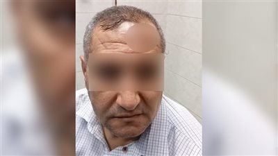 تعليم الدقهلية تكشف تفاصيل التعدي على مدير مدرسة ميت الفرماوي وتحيل الواقعة للنيابة  