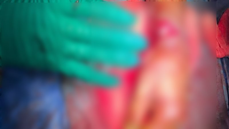عملية جراحية لإعادة