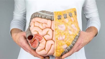 ما هي أعراض مرض كرون؟