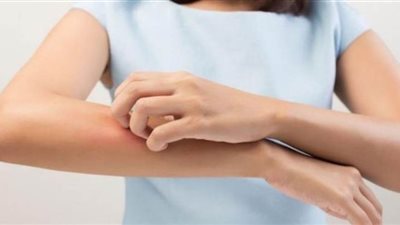 وصفة طبيعية تخفف حكة الجلد