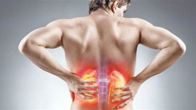 طرق بسيطة تساعد في علاج حصوات الكلى