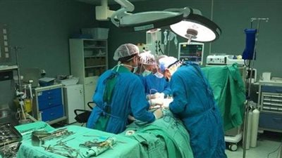 فريق طبي بمستشفى المنصورة ينجح في فصل توأم ملتصق بالعمود الفقري