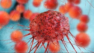 تفسير رؤية الورم في المنام وعلاقته بتغيير الوضع الاجتماعي إلى الأفضل 