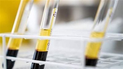 مش مكلف لو كنت جادا.. رسوم ترخيص مراكز الدم بالقانون الجديد