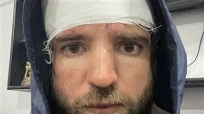 مشاجرة وتكسير كاميرا.. القصة الكاملة للاعتداء على المصور الروسي في حي الزبالين 