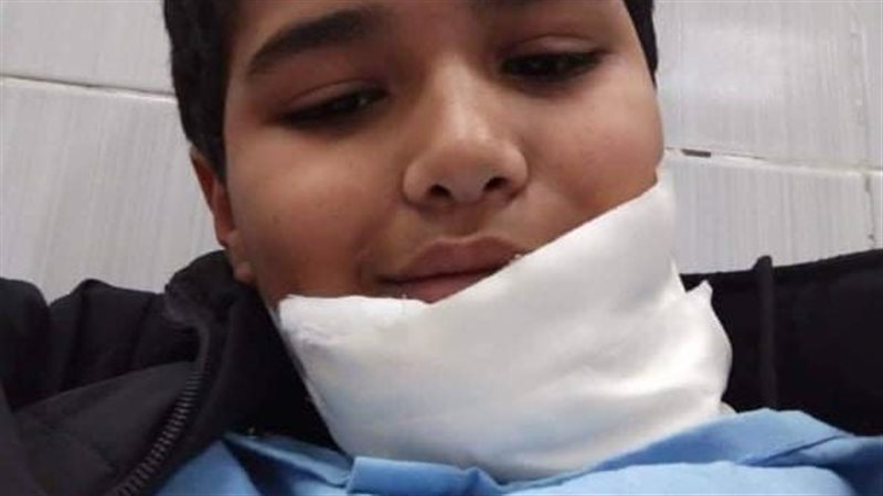 الطفل سيف الدين بعد