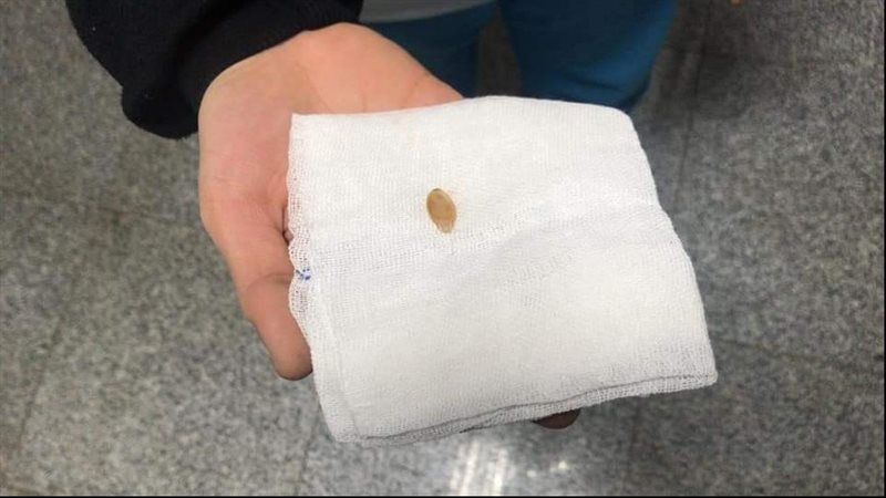 استخراج قشرة لب