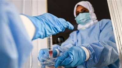 تعرف على شروط مزاولة مهنة التحاليل الطبية وعقوبة المخالفين بالقانون