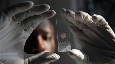 بدء استخدام المصل الجديد المضاد للملاريا في عدد من الدول الإفريقية