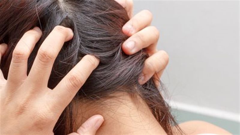 حكة الرأس 