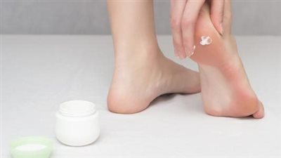 أبرزها العسل والألوفيرا.. وصفات طبيعية لعلاج تشقق القدمين