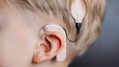 التأمين الصحي: قوائم الانتظار 207 حالات زراعة القوقعة 