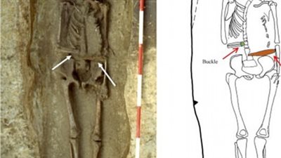 هيكل عظمى لمحارب إيطالى ذراعه المبتورة مستبدلة بسكين 