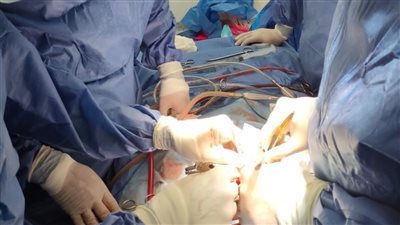 بدء تشغيل وحدة جراحات قلب الأطفال بمستشفى ملوى التخصصي بالمنيا| صور