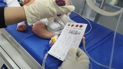 فحص 75 ألف طفل حديث الولادة ضمن مبادرة الكشف المبكر عن الأمراض الوراثية