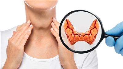 أعراض الغدة الدرقية الخاملة وطرق العلاج بنظام غذائي متكامل