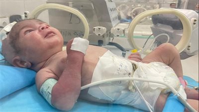 الصحة: نجاح منظومة التشخيص عن بعد في إنقاذ حياة طفل حديث الولادة