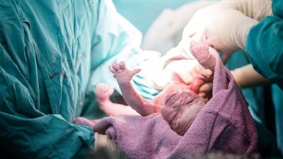 تفسير حلم الولادة في المنام وعلاقته بتغير الأحوال إلى الأفضل