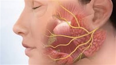 أهمها الحمى الخفيفة، الأعراض الأولية لشلل بيل