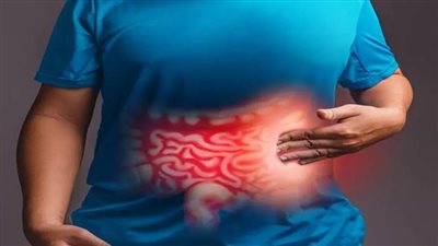 أعراض وأسباب الإصابة بالقولون العصبي