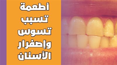 أطعمة تسبب تسوس وإصفرار الأسنان | انفوجراف