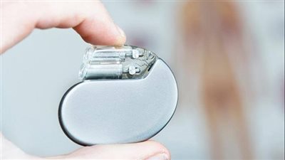 الرعاية الصحية: إجراء عمليات تركيب منظم ضربات القلب بـ٣٠٠ جنيه فقط