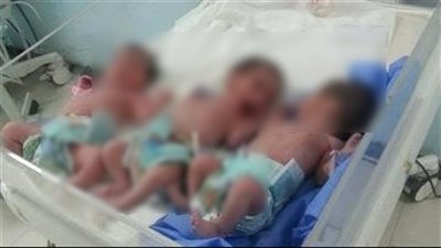 الرعاية الصحية: نجاح ولادة 3 توائم لسيدة حامل في الشهر الثامن بعد تأخر الإنجاب 7 سنوات 