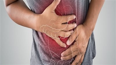 أطعمة ومشروبات ممنوعة لمريض القولون العصبي