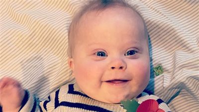 في اليوم العالمي لمتلازمة داون.. 3 نصائح من الصحة لرعاية الأطفال المصابين