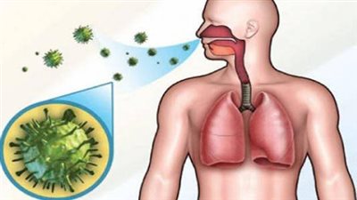  أبرزها تورم الرقبة، اعراض وعلاجات مرض السل