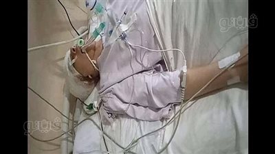 أصيب بنزيف في المخ.. طالب يعتدي على زميله داخل مدرسة ثانوية بالشرقية | صور