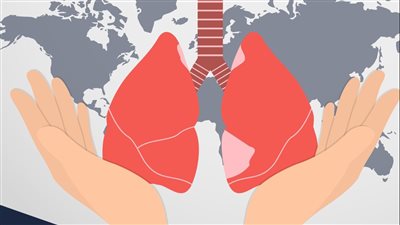 الصحة: خطة لخفض معدل الإصابة بالدرن.. وإنشاء مركز جديد في أسيوط 