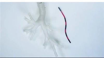 تطوير روبوت يخترق أنابيب الرئة ويأخذ عينات من الأنسجة