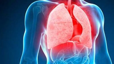 الصحة تكشف أعراض مرض الدرن، وهذه طريقة تشخيص الإصابة 