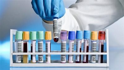 د. شريف غبريال يكتب: مشروع قانون معامل التحاليل فئوي وإقصائي.. ويصدر أزمات 