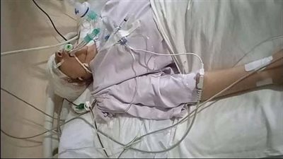تطور جديد في الحالة الصحية للطالب محمود بعد تعدى زميلة عليه بالشرقية