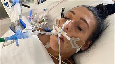 بعد عملية تنحيف.. شابة تصاب بعدوى خطيرة نادرة