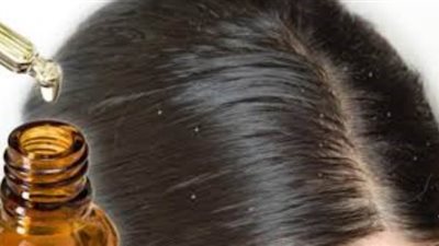 3 خلطات من مطبخك تخلصك من قشرة الشعر نهائيا وتحافظ على نعومته