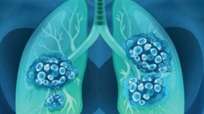 4 أعضاء في الجسم يهاجمها كورونا غير الرئة