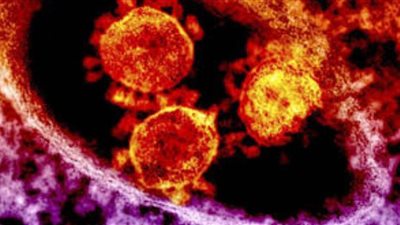 لمرضى القلب.. اتبع هذه التعليمات لتفادى مخاطر الكورونا