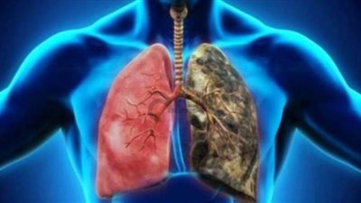 احذر.. فيروس كورونا يتلف رئة المصاب حتى دون أعراض