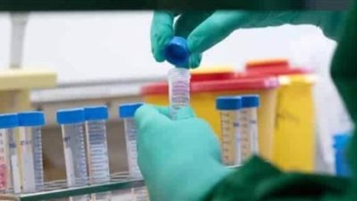 وزير التعليم العالي: الرئيس وجه بتصنيع دواء 