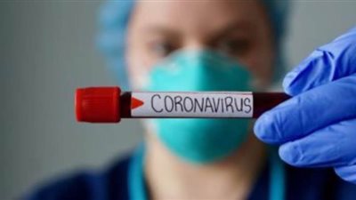 روسيا تسلم الاتحاد الأوراسي 60 ألف اختبار لفيروس كورونا