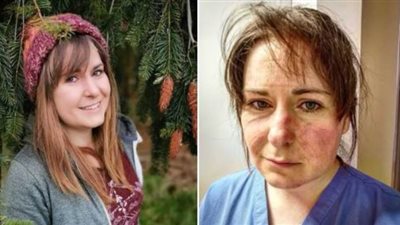 ممرضة بريطانية تحث المواطنين على عدم الخروج من المنزل: 