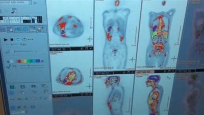 تعقيم العناية المركزة والمسح الذرى للمرضى بالمستشفى التعليمي بطنطا