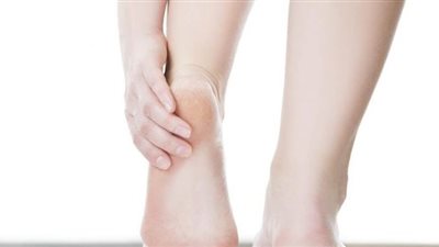 3 وصفات من الطبيعة تخلصك من تشقق القدمين في زمن قياسي