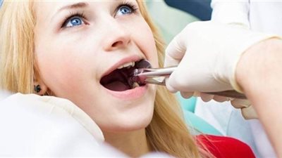 حالات تستوجب خلع ضرس العقل